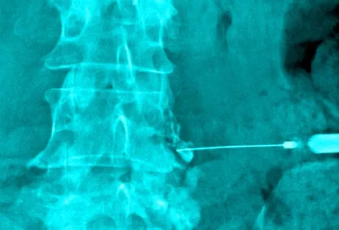 Fun,Entertainment,Wallpapers, Videos, Jokes & mOre Only @ MumbaiRock Click Here if You cant see Images