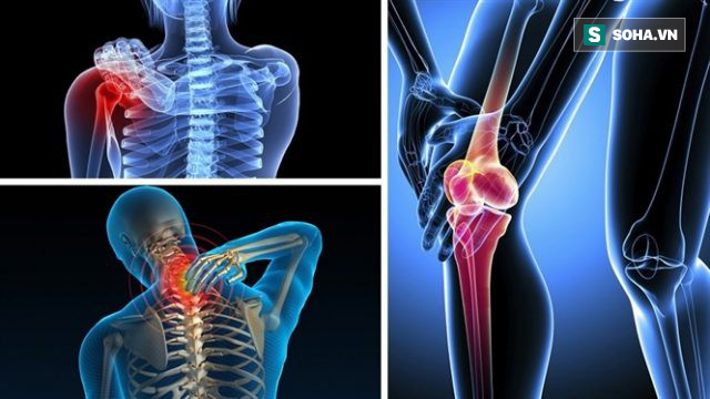 Đau cổ vai gáy lưng và xương khớp từ đầu đến chân: Chỉ cần tập 5 động tác này là sẽ đỡ hẳn - Ảnh 1. Đau cổ vai gáy lưng và xương khớp từ đầu đến chân: Chỉ cần tập 5 động tác này là sẽ đỡ hẳn - Ảnh 1.