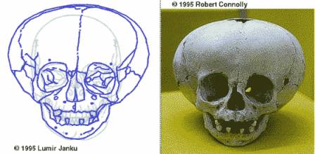 cranio-1