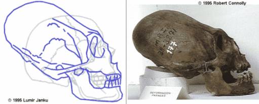 cranio-2