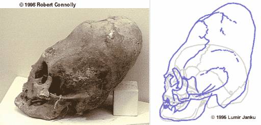cranio-3