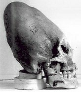 cranio-4