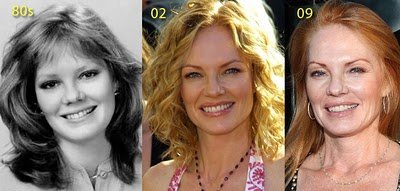 https://4.bp.blogspot.com/-IB2WSjfTASo/UKZxxmKQmuI/AAAAAAAAgNI/IM9po7HsDpU/s1600/marg-helgenberger-plastic-surgeryMA29103085-0011.jpg