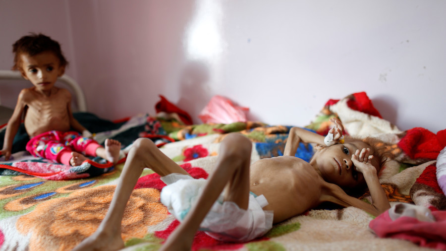 Starving Yemeni girl from shocking NYT photo dies as bombing & blockade continues