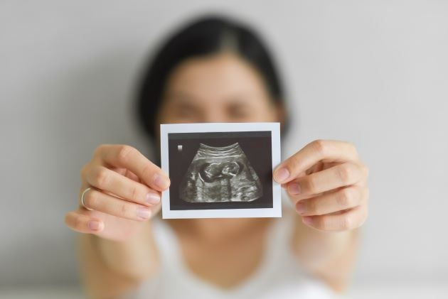 A pregnant woman shows her ultrasound to the camera. © By eggeeggjiew/stock.adobe.com