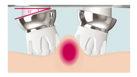 Alternate text Alternate text