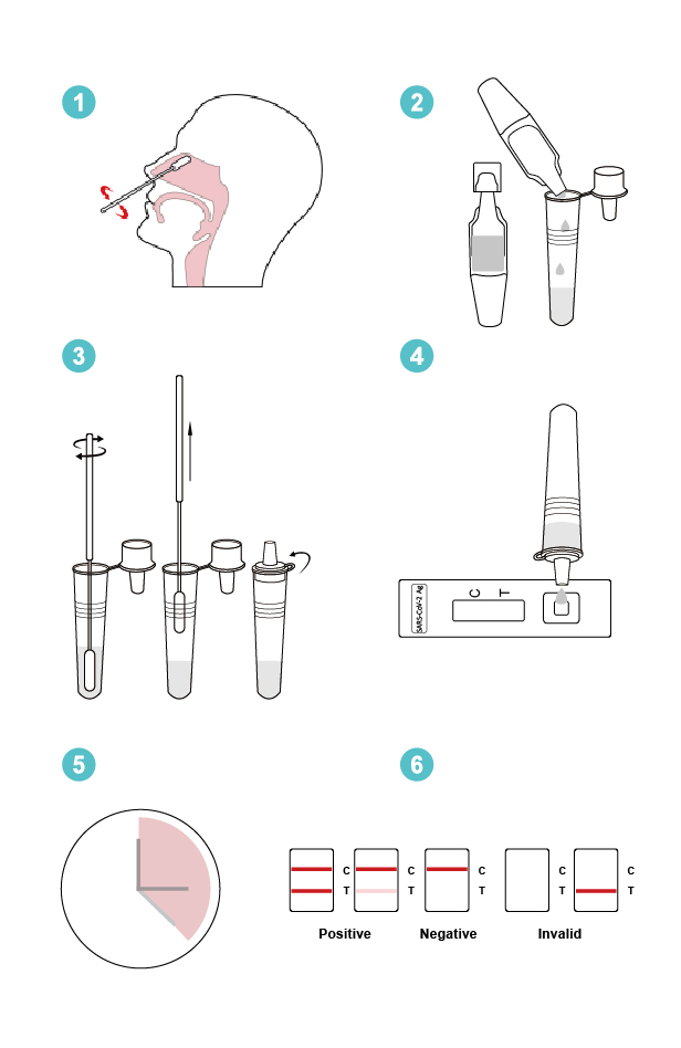 JOYSBIO SARS-COV-2 Antigen Rapid Test Kit Operating Procedure