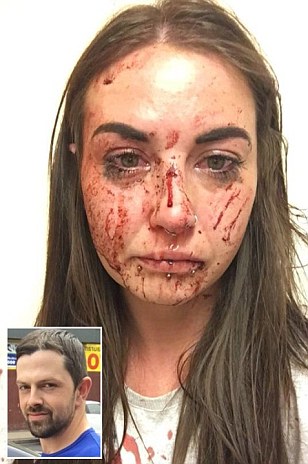 Boyfriend ordered to pay woman £75 compensation for leaving her drenched in blood