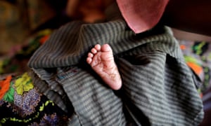 A  newborn Rohingya baby