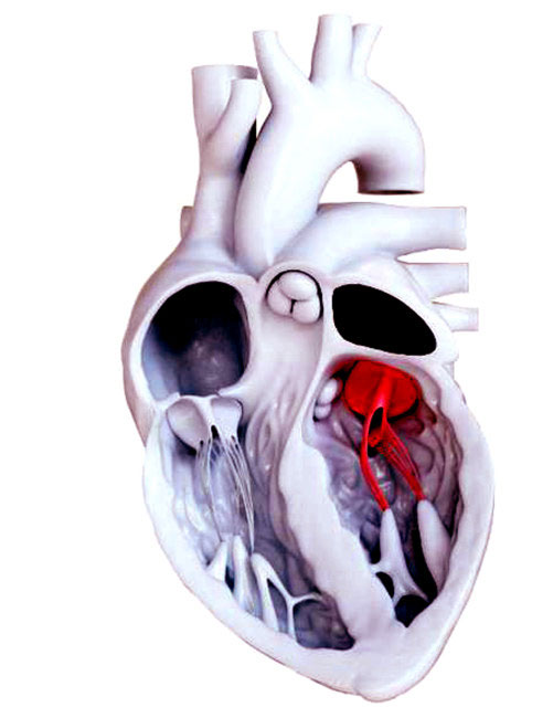 Mô hình cho thấy van hai lá (màu đỏ) nằm ngay trung tâm của tim.