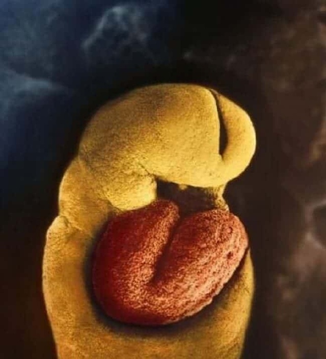 Những bức ảnh đáng kinh ngạc về sự phát triển của thai nhi trong bụng mẹ - 8