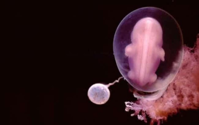 Những bức ảnh đáng kinh ngạc về sự phát triển của thai nhi trong bụng mẹ - 9