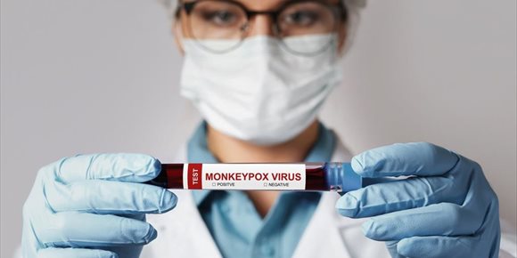 1. Un paso más en el conocimiento de la viruela del mono: ¿es una enfermedad de transmisión sexual?