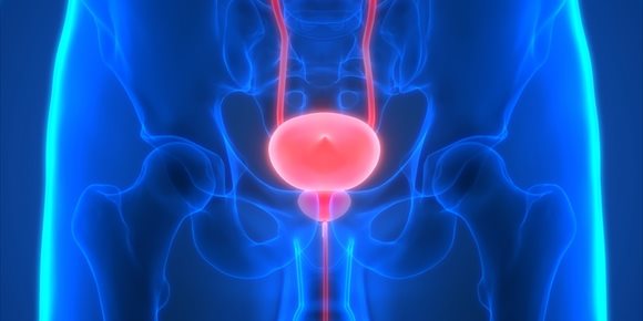 5. La terapia hormonal para el cáncer de próstata aumenta el riesgo de enfermedad cardiovascular