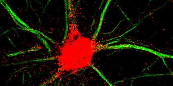 5. Un nuevo fármaco en investigación aumenta el crecimiento neuronal en células nerviosas
