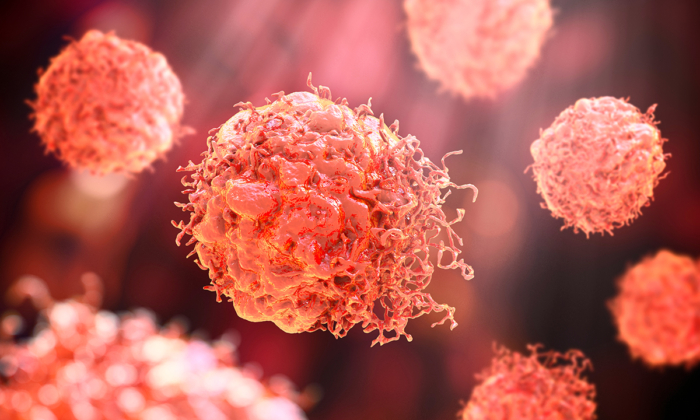 mRNA COVID Vaccines May Be Triggering Deadly ‘Turbo Cancers’