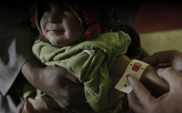 AFGHANISTAN : 1 ENFANT SUR 2 SOUFFRE DE LA FAIM