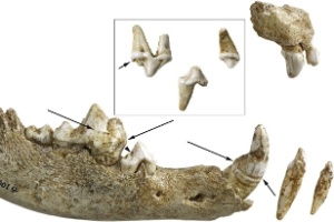 LVR/LandesMuseum Bonn LVR/LandesMuseum Bonn