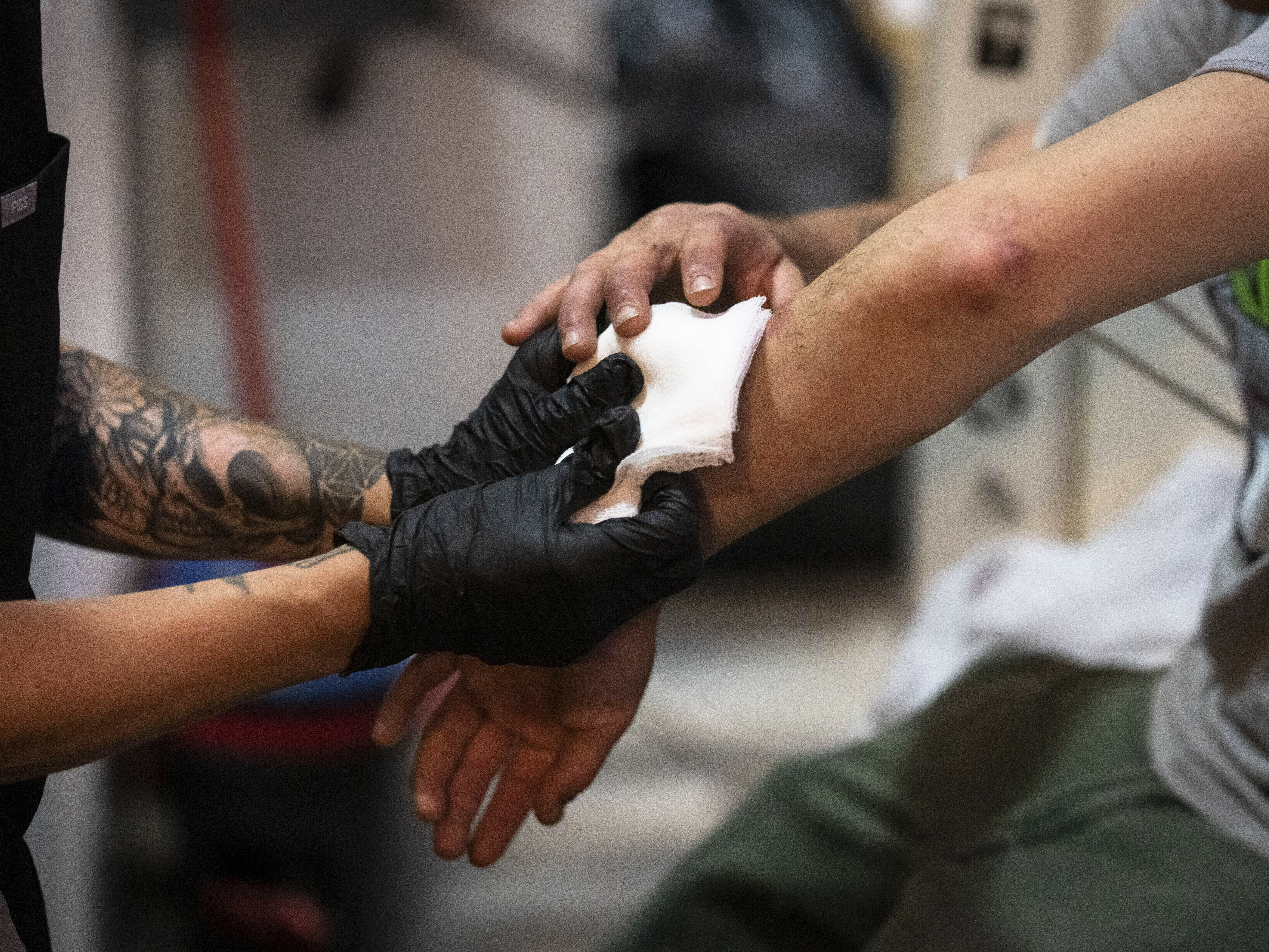 Overdose deaths involving street xylazine surged years earlier than reported Overdose deaths involving street xylazine surged years earlier than reported