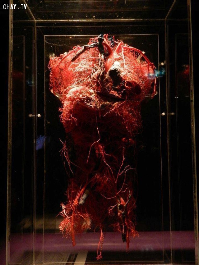 Hệ thống mạch máu phần trên của cơ thể,cơ thể con người