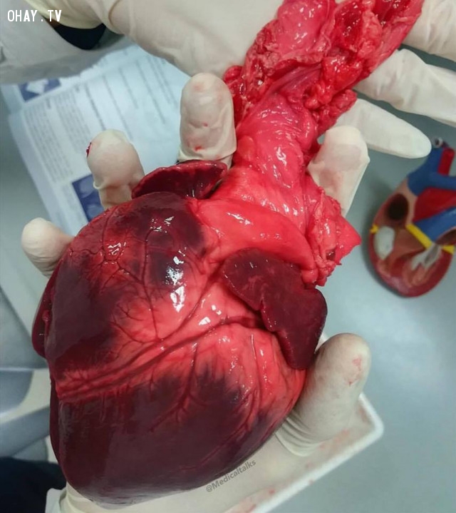 Bức ảnh của một trái tim khỏe mạnh,cơ thể con người