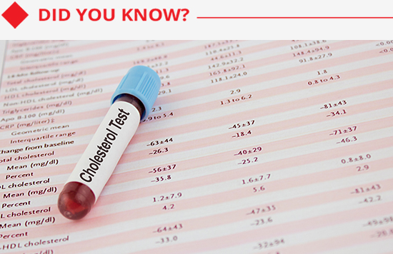 Blood vial labeled cholesterol test