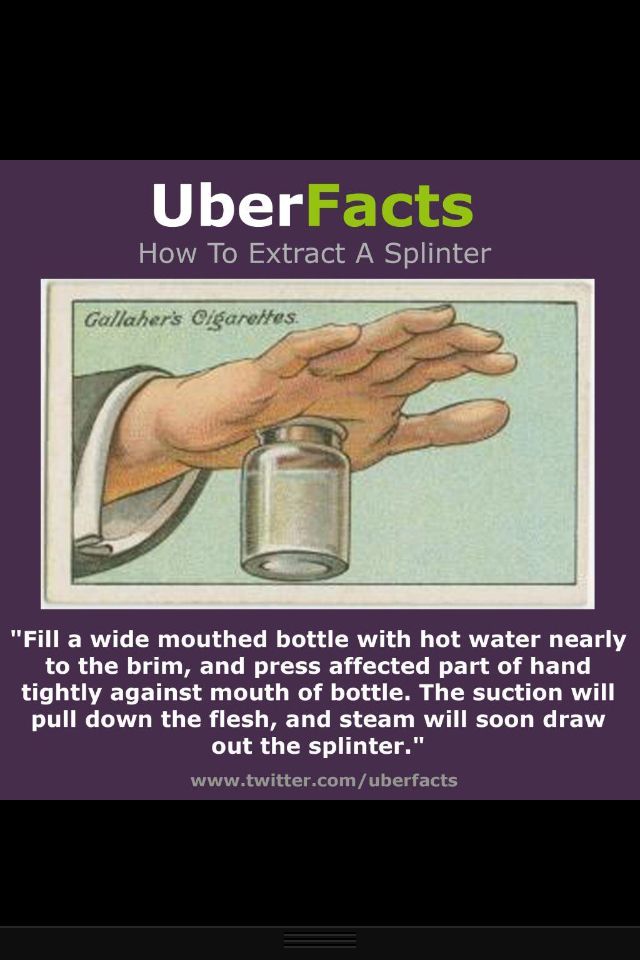 Image result for how to extract a splinter