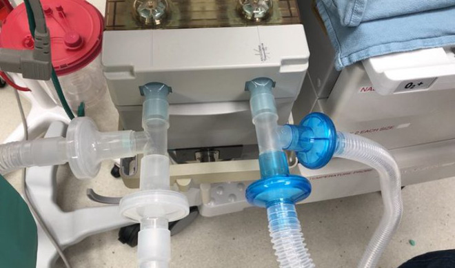 Máy thở là gì mà nước nào trên thế giới cũng đang chạy đua để có càng nhiều càng tốt? - Ảnh 3. Máy thở là gì mà nước nào trên thế giới cũng đang chạy đua để có càng nhiều càng tốt? - Ảnh 3.