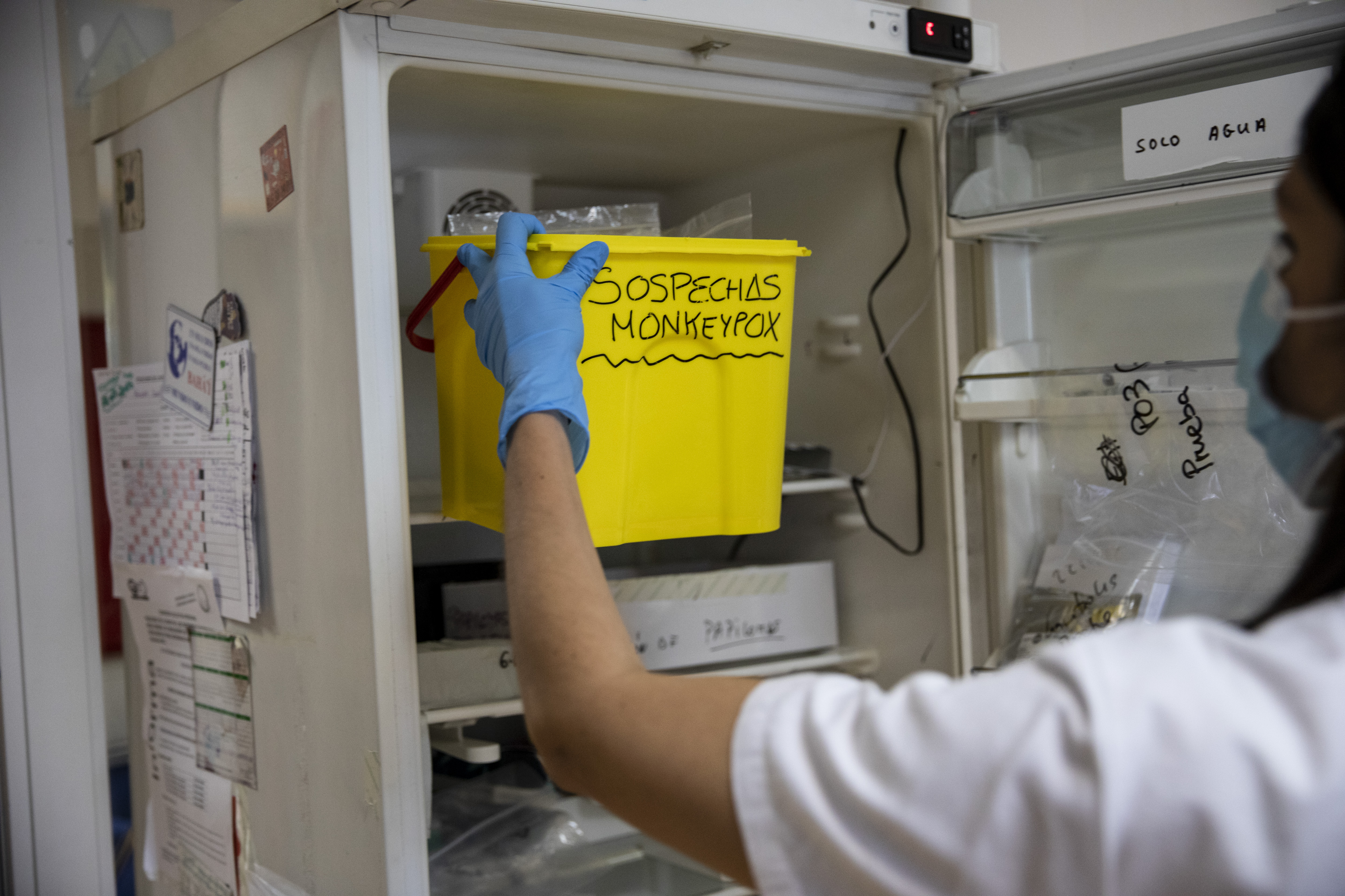 A lab technician holds a box with suspected monkeypox samples.