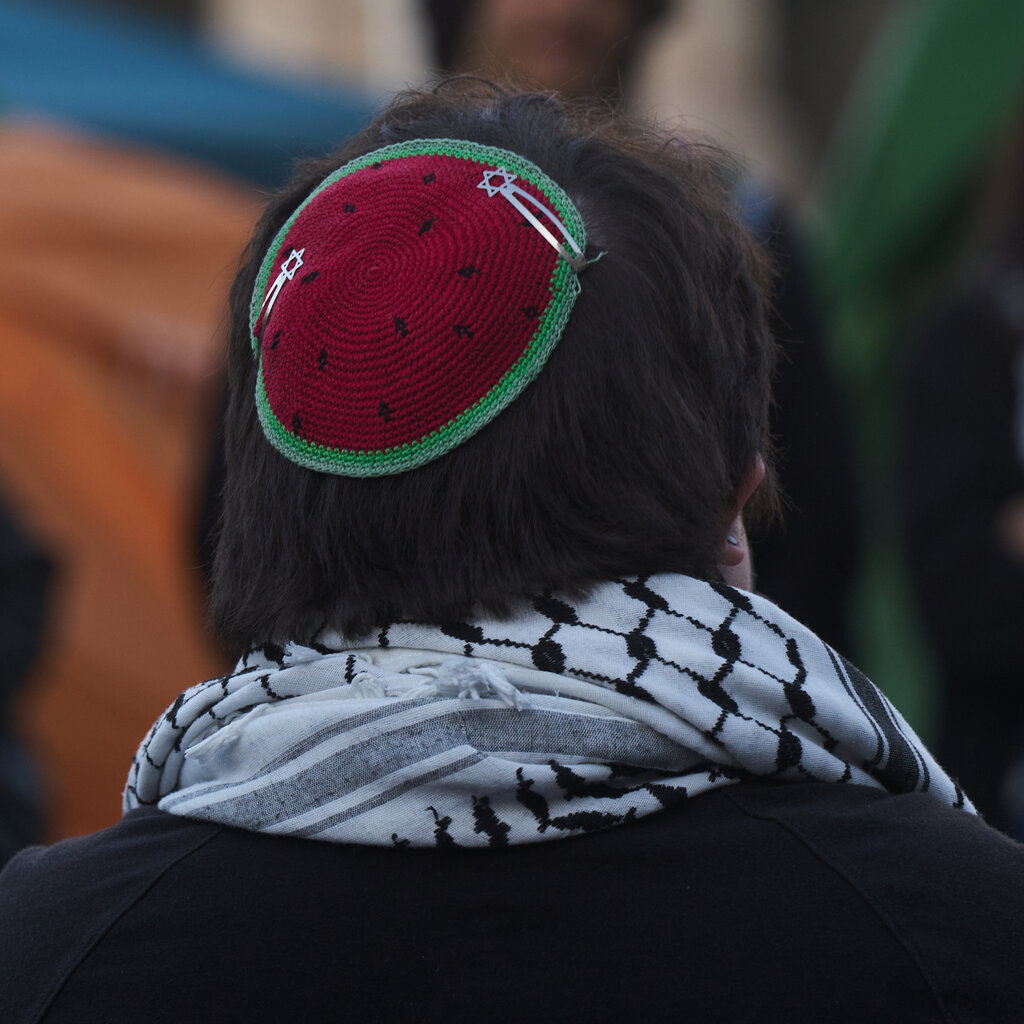 A man wearing a kippah on his head that looks like a watermelon. 