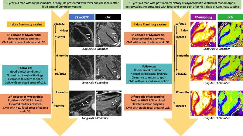 1-s2.0-S2590136223000591-gr1.jpg 1-s2.0-S2590136223000591-gr1.jpg