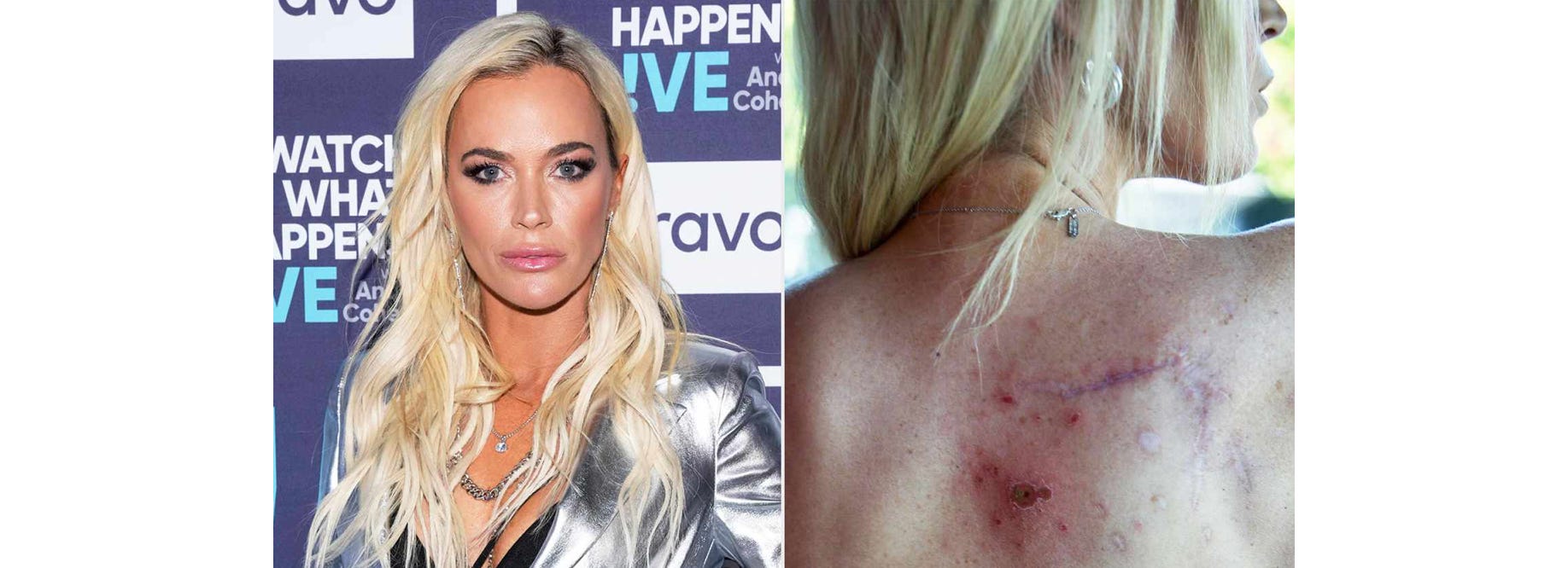 image 14.png image 14.png