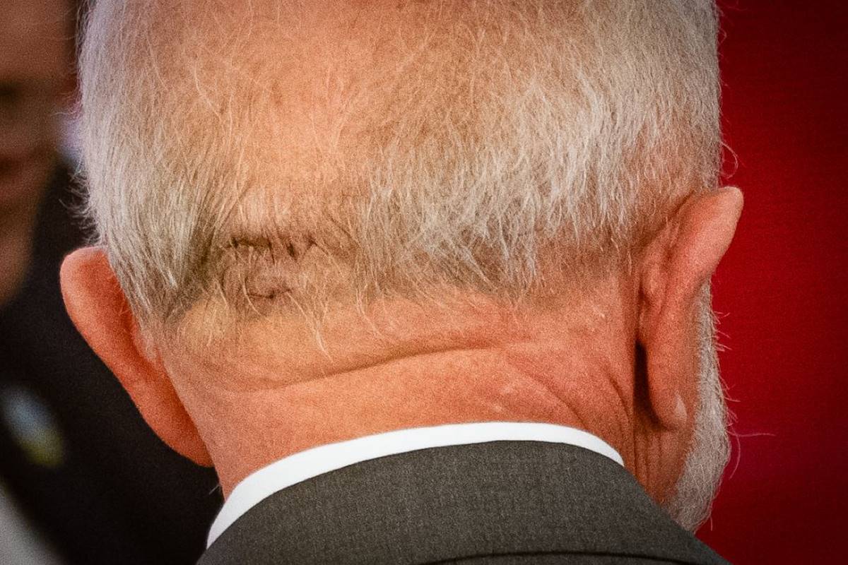 Imagem colorida de Pontos na cabeça do presidente Lula