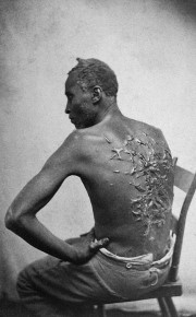 Gordon, an enslaved man, who received these scars as a result of beating by his enslavers. He later served in the Union Army