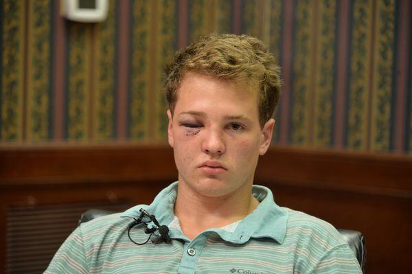 Huntsville High School graduate Collins Nelson talks to reporters June 4, 2019, about a group of men and women he says attacked him and his friends on a river float trip.