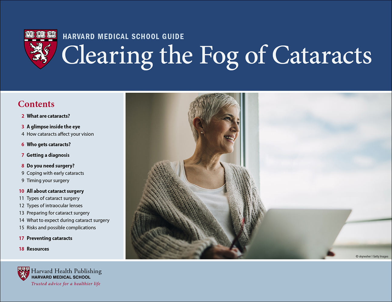 Clearing the Fog of Cataracts