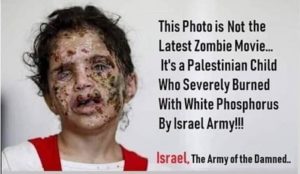 Supporters of “Palestinian” jihad use photo of girl injured in Yemen to claim Israeli war crimes in Gaza