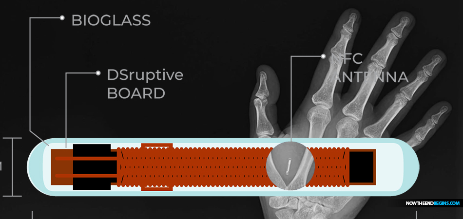 DSruptive-sweden-human-implantable-microchip-666-covid-mark-of-the-beast